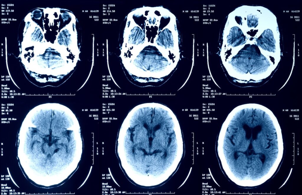 medical-imagery-getty-scans.jpg