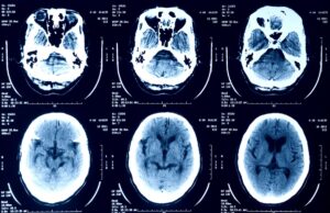 medical-imagery-getty-scans.jpg
